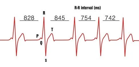 Hartslagvariabiliteit