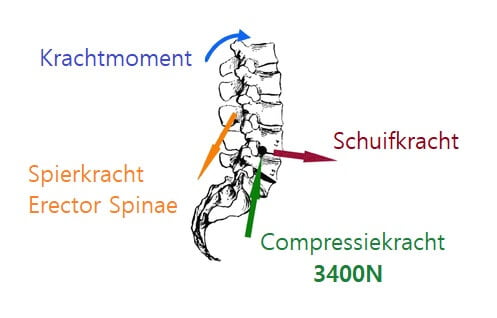 NIOSH compressiekracht lage rug